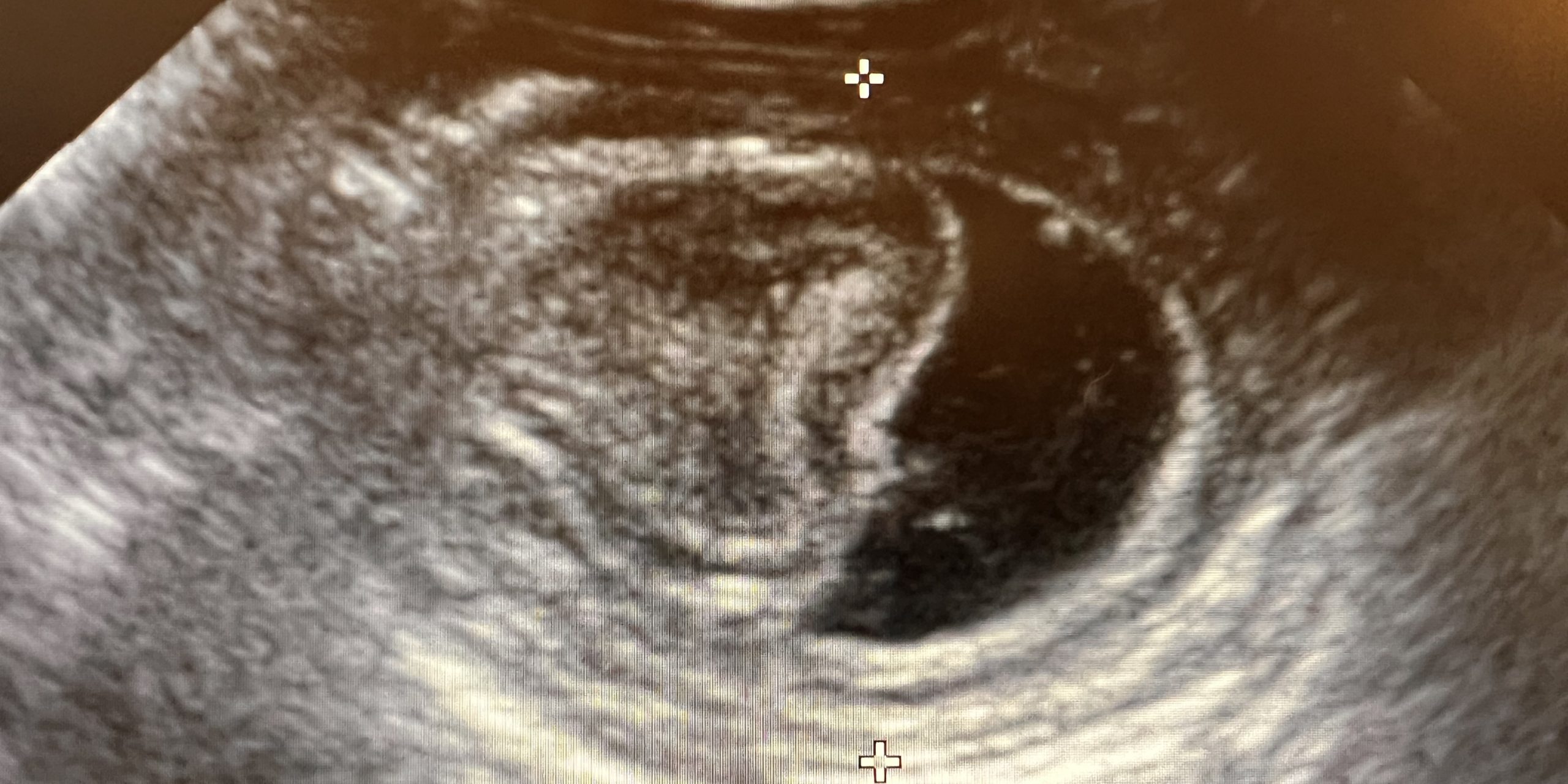 intussusception chez le chat