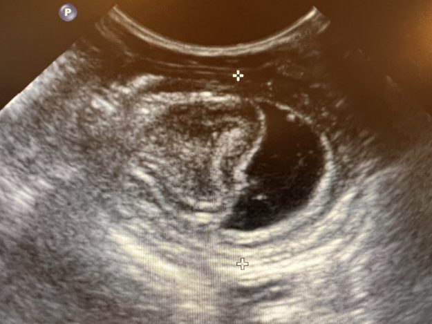 intussusception chez le chat