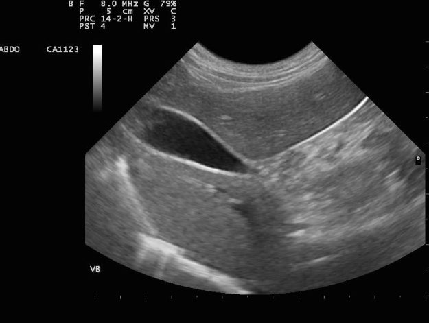 echographie abdominale veterinaire paris echographie abdominale veterinaire paris