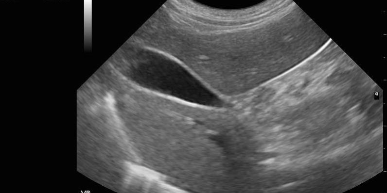 echographie abdominale veterinaire paris